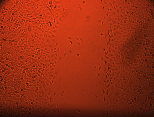 Description: C:\Users\cwols001\AppData\Local\Microsoft\Windows\Temporary Internet Files\Content.Outlook\JAOO8C5Z\wound post.jpg